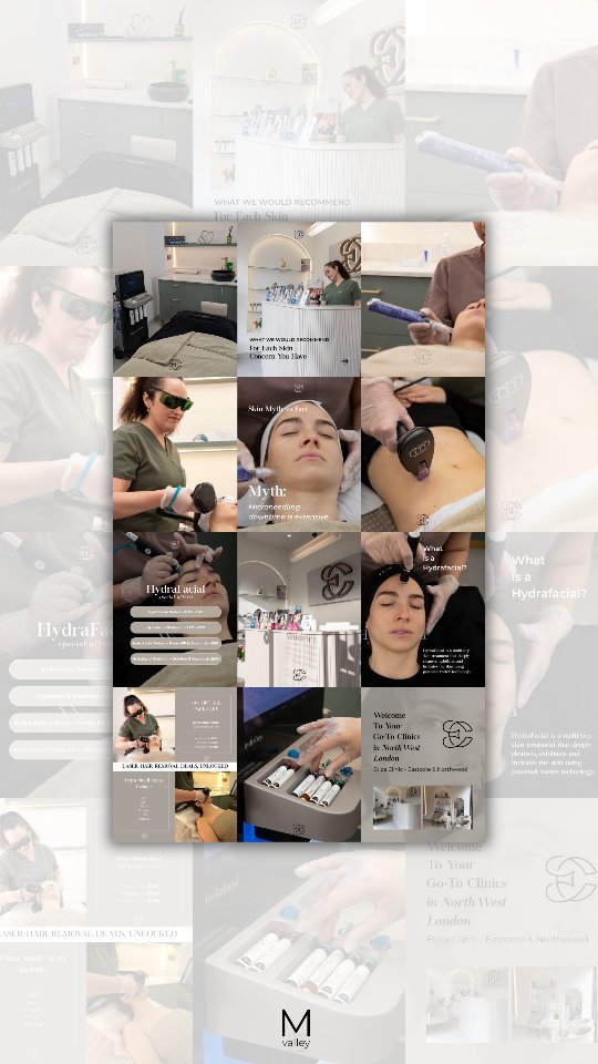 Some behind the scenes of creating content that reflects the level of the clinic, the treatments, and the experience behind the brand 🙌

From treatment shots to atmosphere details, every piece of content is created with the intention of helping the clinic communicate its expertise and elevate its digital presence online.

Our focus here was to mix treatment offers and features with the values, atmosphere, and overall experience of choosing the clinic, creating content that feels engaging, informative, and aligned with the brand’s positioning.

One of the biggest mistakes clinics make on social media is focusing only on treatments. People are not just choosing a procedure, they are choosing the experience, the environment, the professionalism, and how the brand makes them feel.

• Show the clinic atmosphere, not just close-up treatment shots
• Include human moments and interactions
• Mix educational content with lifestyle and brand experience
• Create content that reflects the feeling of being a client
• Incorporate trends but keep your branding and visuals consistent across every post

Try these ideas and see if your content starts feeling more engaging, elevated, and aligned with the experience your brand actually offers.

MV team x
.
#contentcreation #socialmedia #socialmediatips #socialmediamanagement #clinicmarketing