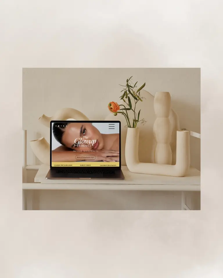 Marketing Valley portfolio project featuring The Glowup Lounge website design on laptop