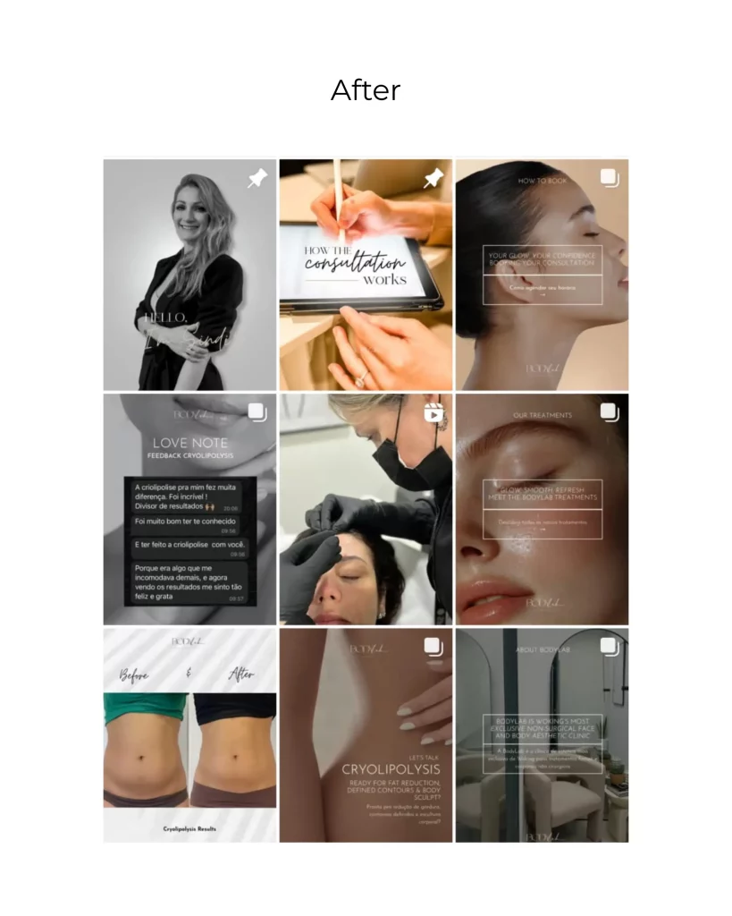 BodyLab Aesthetics Instagram feed after Marketing Valley’s social media management, showing cohesive branding, polished visuals, and professional design