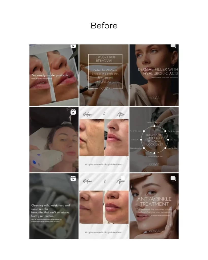 BodyLab Aesthetics Instagram feed before Marketing Valley’s social media management, showing inconsistent visuals and mixed styles