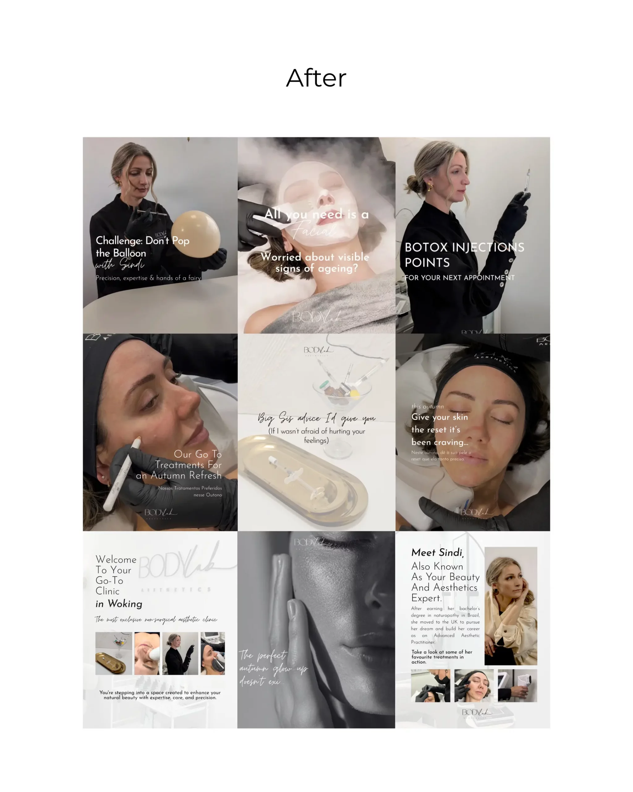 Social media management and content creation project for BodyLab Aesthetics in Woking Esher