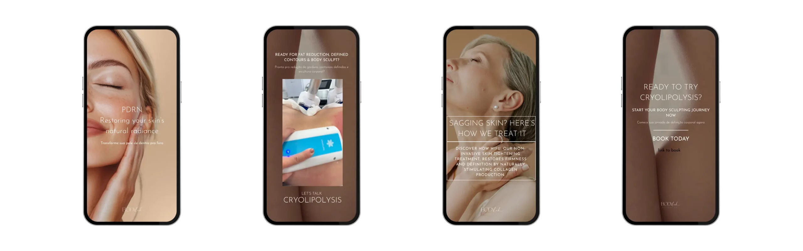 Social media stories designed for BodyLab Aesthetics by Marketing Valley, featuring treatments including PDRN, Cryolipolysis, and HIFU