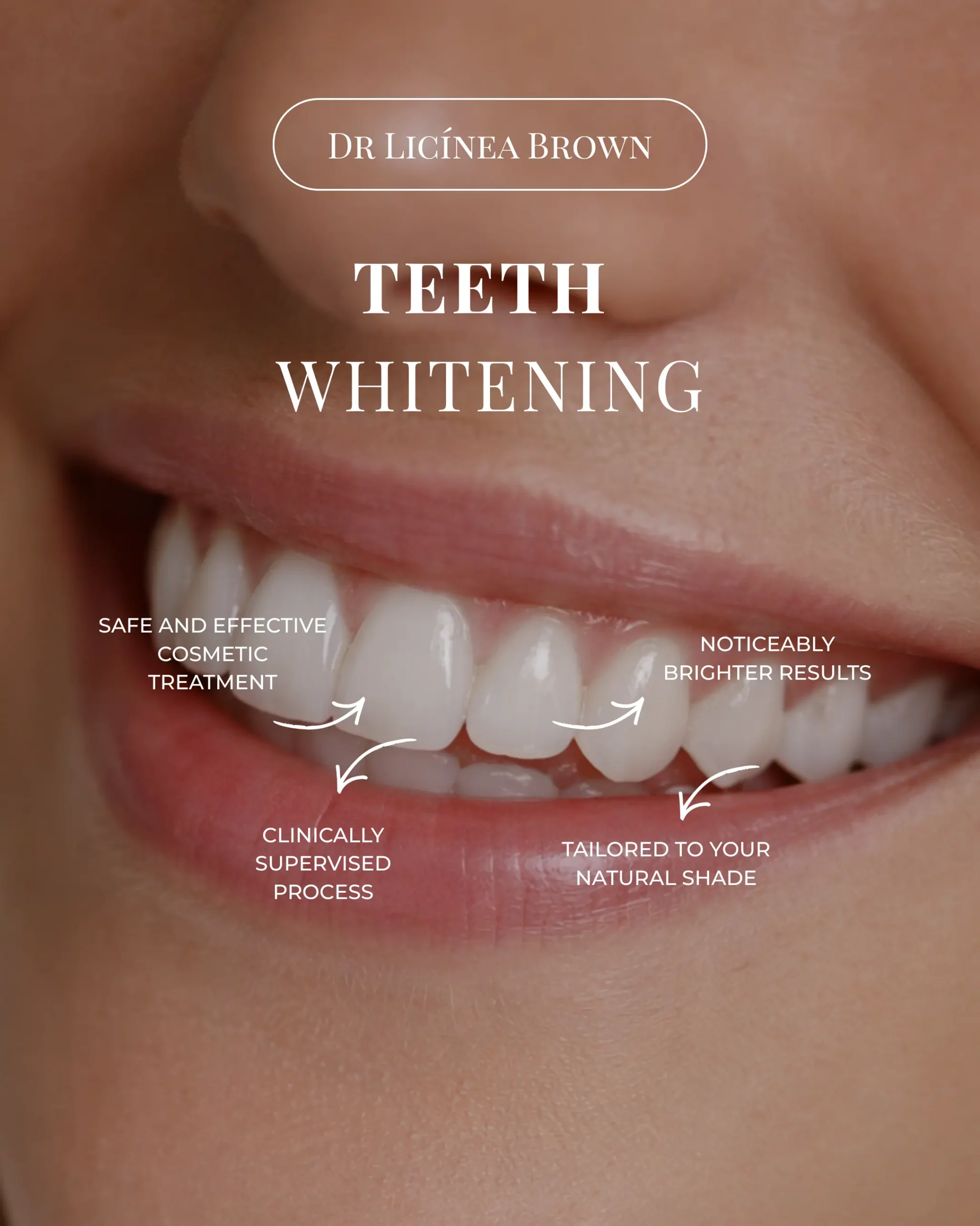 Dental content creation example for Dr Licínea Brown featuring educational social media content and branding agency