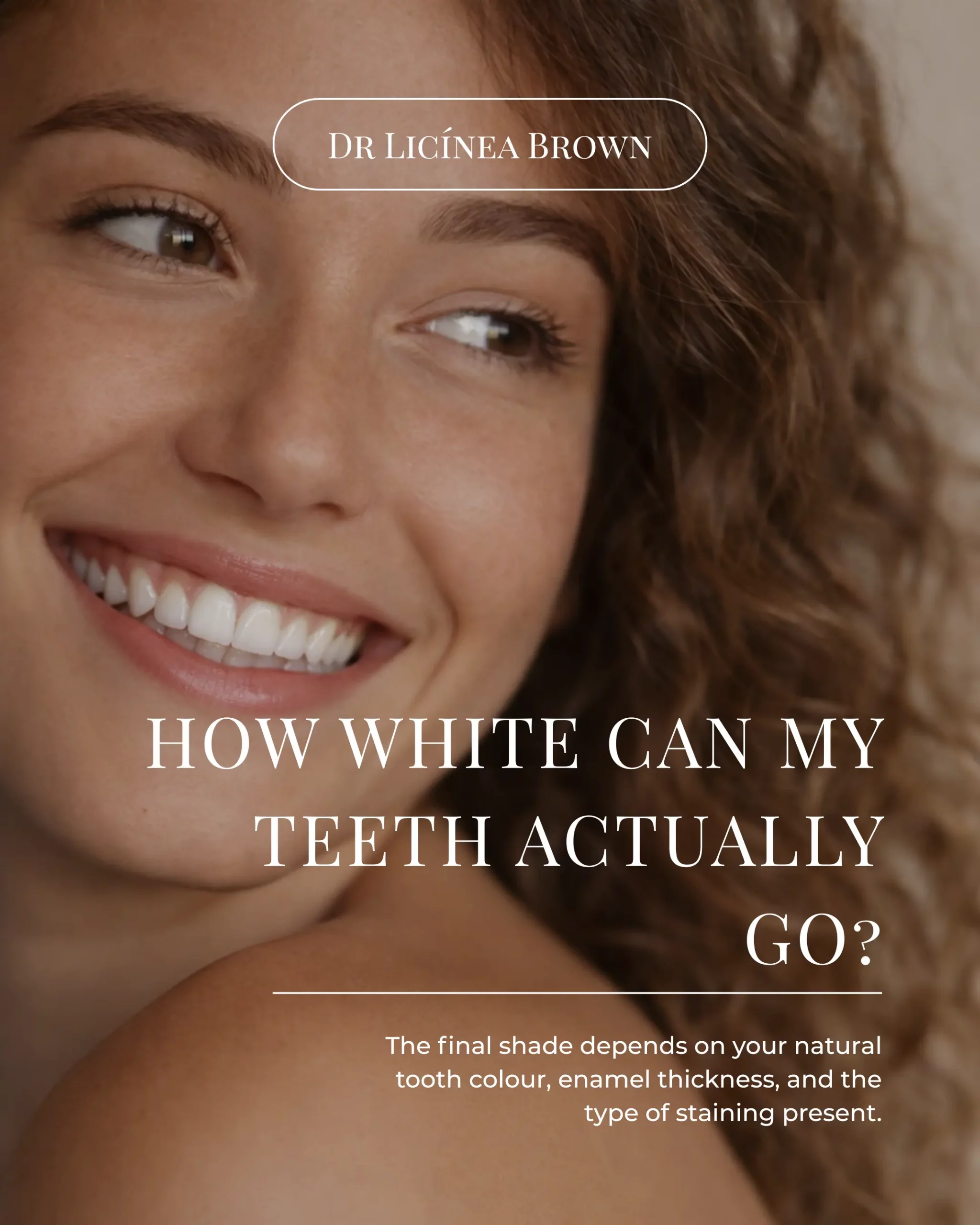 Instagram post example created for Dr Licínea Brown showcasing dental educational content and social media marketing agency chessington