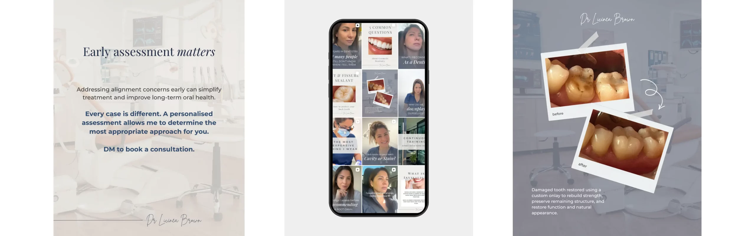 Dental social media management and content creation portfolio banner for Dr Licínea Brown by Marketing Valley Agency Esher