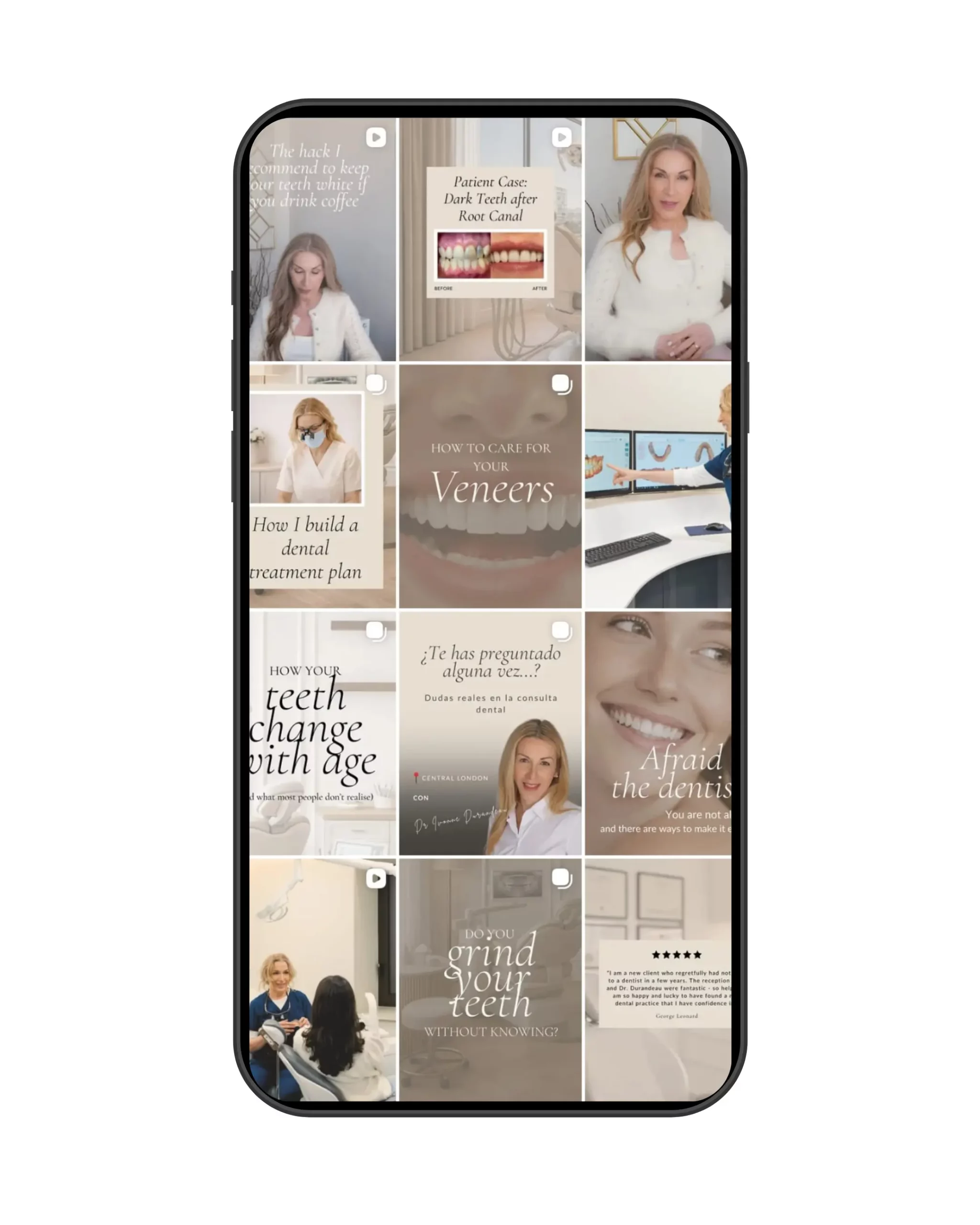 Instagram feed design and social media content creation for a London dentist showcasing educational dental marketing content by Social media agency chessington